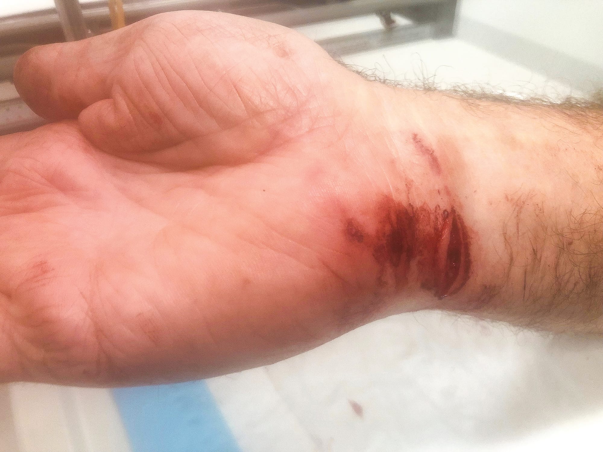 Call for clampdown on aggressive dog