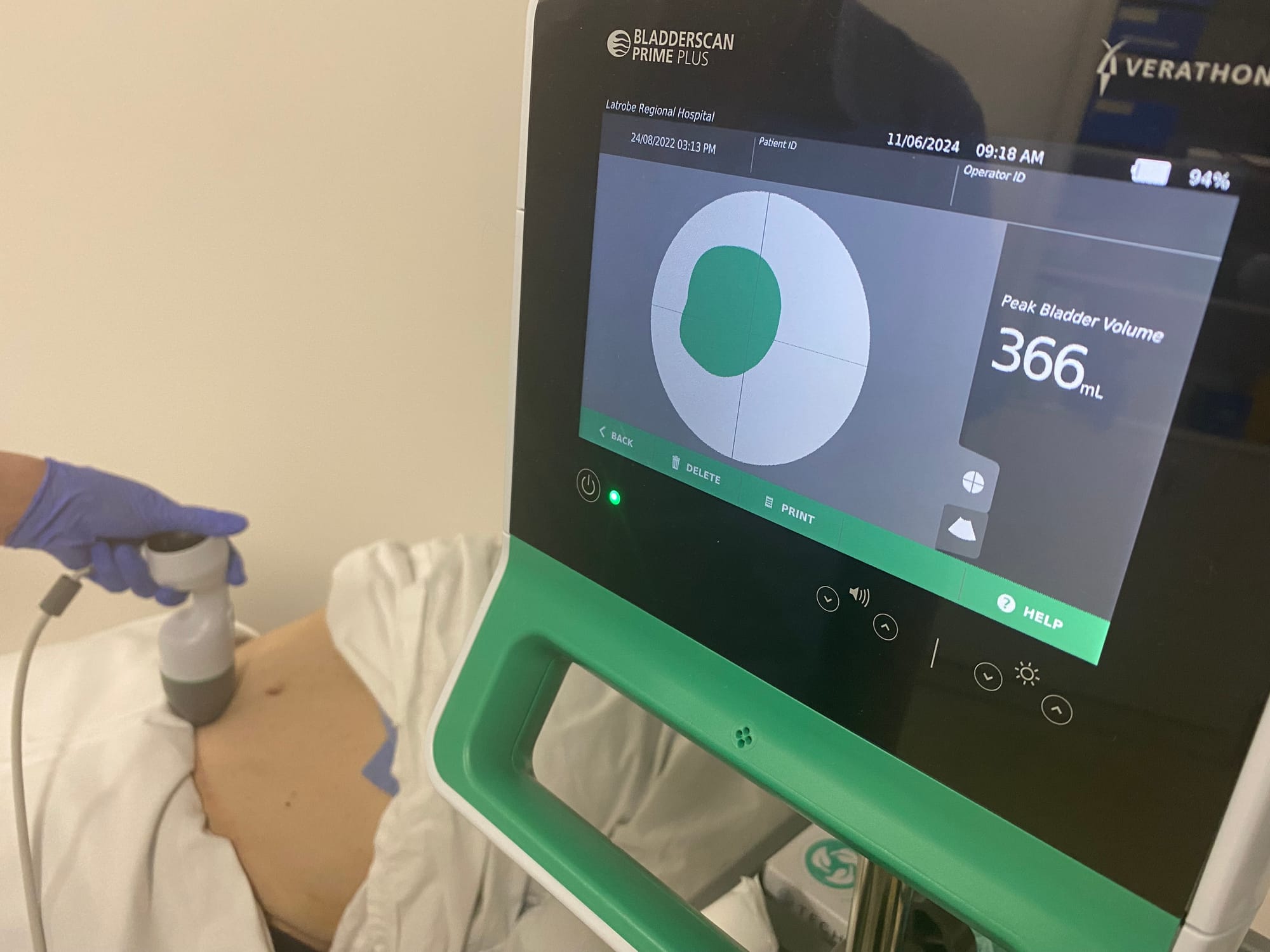 Incontinence: more of a problem than you might think