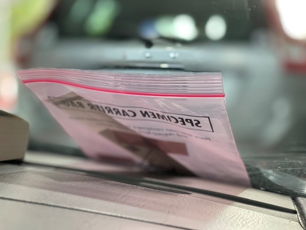 Covid numbers not an accurate reflection of local infection post image