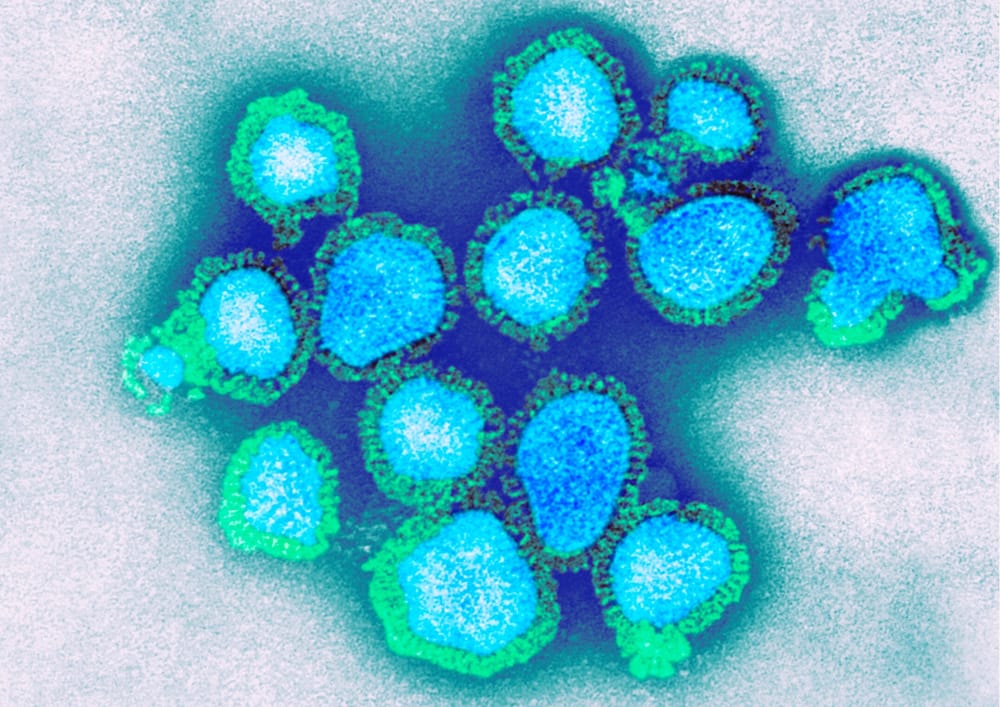 Welcome back Melbourne post image