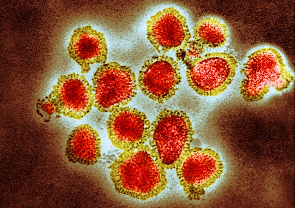 Lockdown lifts for regional Victoria! post image